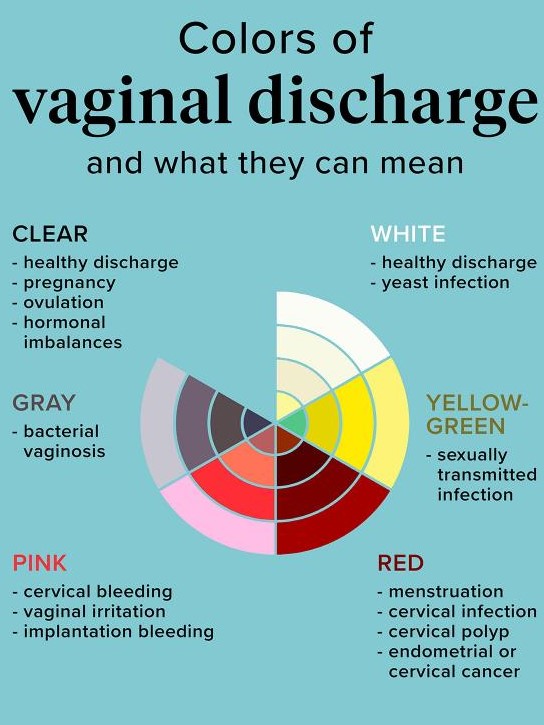 Colours of viginal Discharge 